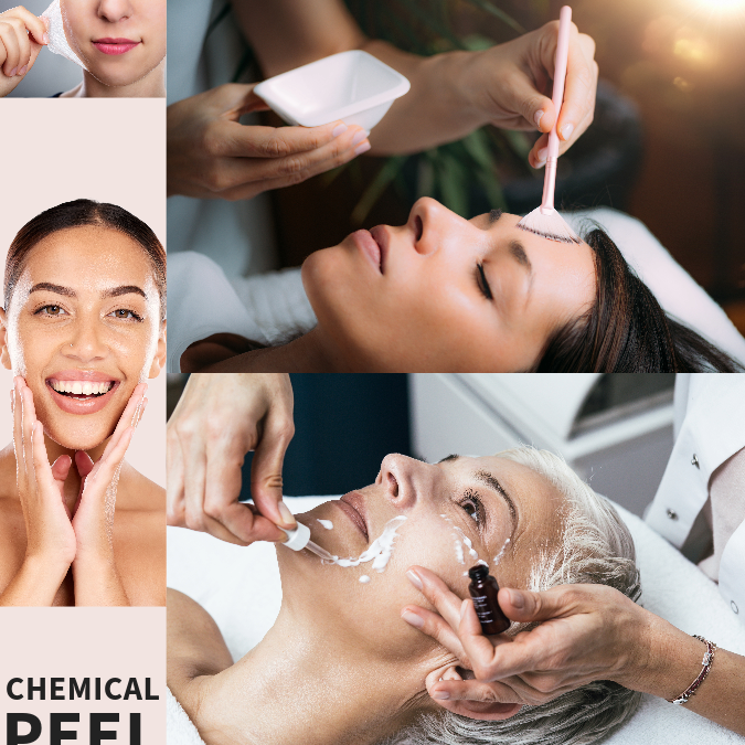 Reveal Your Radiance: The Ultimate Guide to Chemical Peels