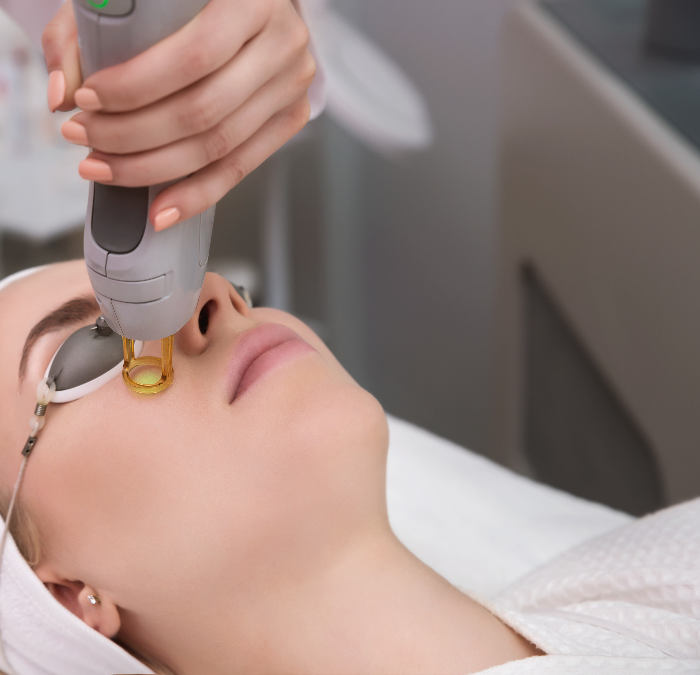 What is IPL (Intense Pulse Light)  and How does it work?